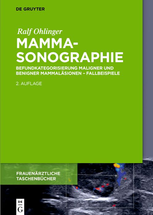 Mammasonographie: Befundkategorisierung maligner und benigner Mammalasionen - Fallbeispiele