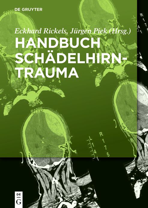 Handbuch Schadelhirntrauma