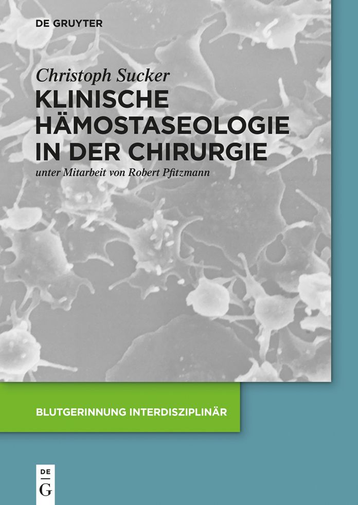 Klinische H#x000E4;mostaseologie in der Chirurgie