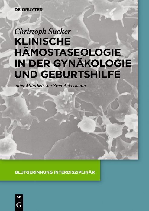 Klinische Hamostaseologie in der Gynakologie und Geburtshilfe