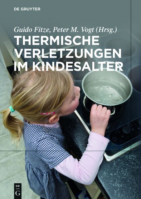 Thermische Verletzungen im Kindesalter