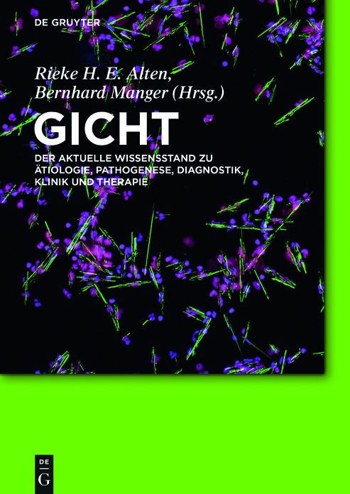 Gicht: Der aktuelle Wissensstand zu Atiologie, Pathogenese, Diagnostik, Klinik und Therapie