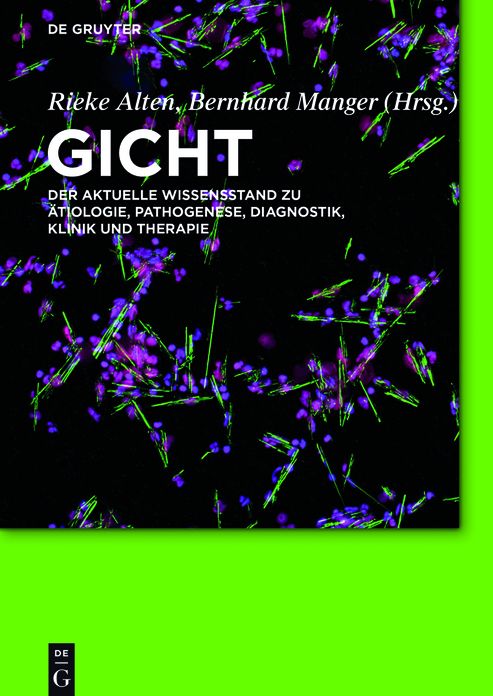 Gicht: Der aktuelle Wissensstand zu #x000C4;tiologie, Pathogenese, Diagnostik, Klinik und Therapie