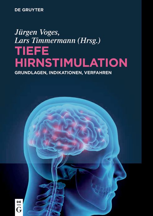 Tiefe Hirnstimulation: Grundlagen, Indikationen, Verfahren