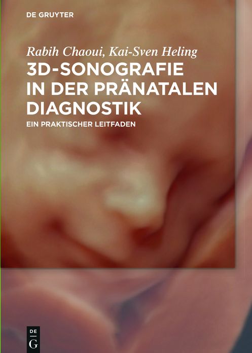 3D-Sonografie in der pranatalen Diagnostik: Ein praktischer Leitfaden