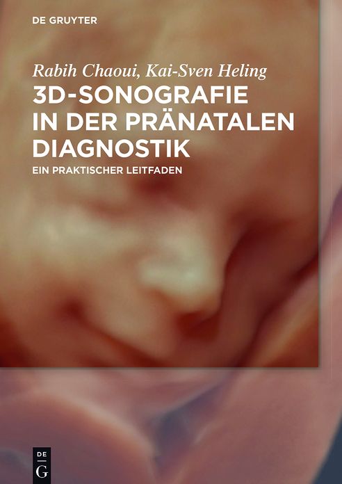 3D-Sonografie in der pr#x000E4;natalen Diagnostik: Ein praktischer Leitfaden