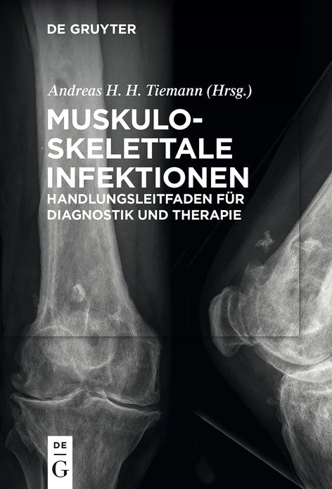 Muskuloskelettale Infektionen: Handlungsleitfaden fur Diagnostik und Therapie