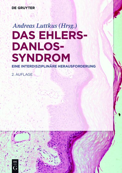 Das Ehlers-Danlos-Syndrom: Eine interdisziplinare Herausforderung