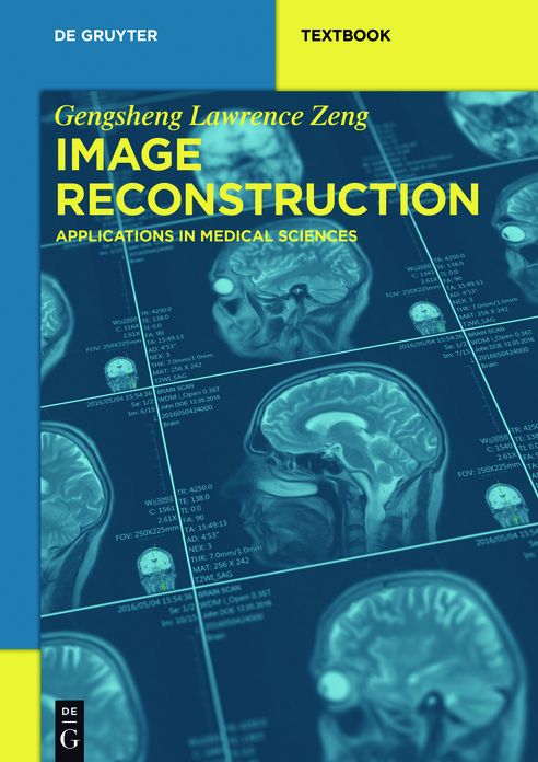 Image Reconstruction: Applications in Medical Sciences