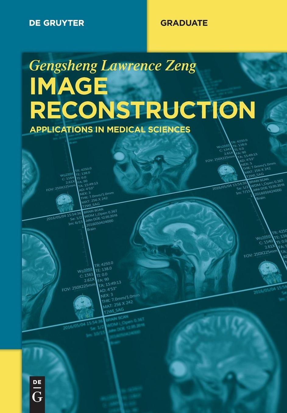 Image Reconstruction: Applications in Medical Sciences