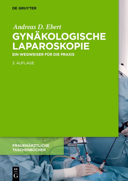 Gynakologische Laparoskopie: Ein Wegweiser fur die Praxis