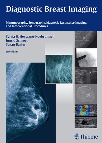 Diagnostic Breast Imaging: Mammography, Sonography, MRI and Interventional Procedures