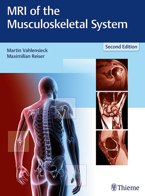 MRI of the Musculoskeletal System