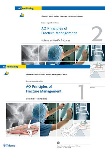 AO Principles of Fracture Management: Vol. 1: Principles, Vol. 2: Specific fractures
