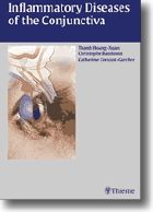 Inflammatory Diseases of the Conjunctivae