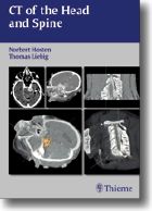 CT of the Head and Spine