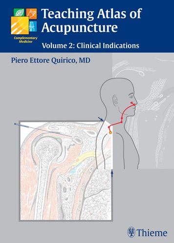 Teaching Atlas of Acupuncture: Clinical Indications