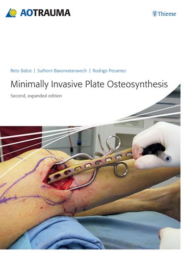 Minimally Invasive Plate Osteosynthesis (MIPO)