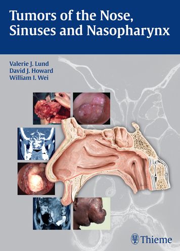 Tumors of the Nose, Sinuses and Nasopharynx