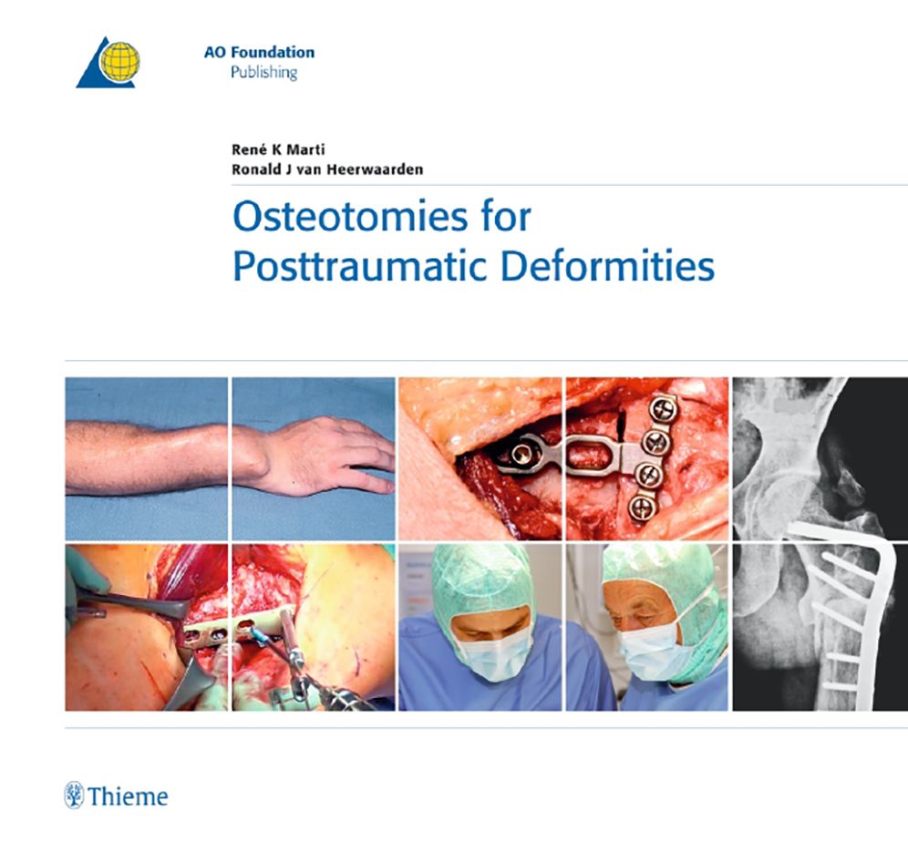 Osteotomies for Posttraumatic Deformities