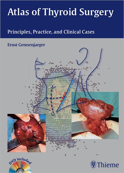 Atlas of Thyroid Surgery: Principles, Practice, and Clinical Cases - Book and DVD