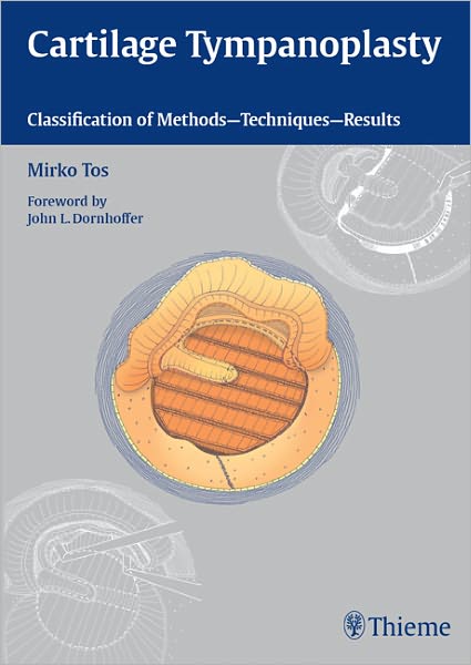 Cartilage Tympanoplasty: Classification of Methods -- Techniques -- Results
