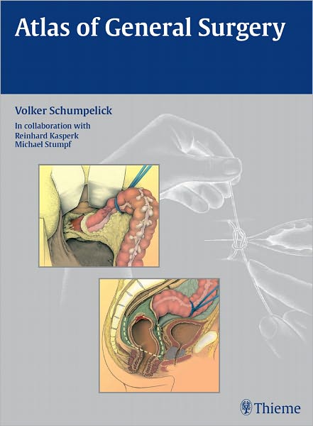 Atlas of General Surgery