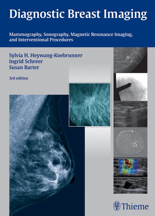 Diagnostic Breast Imaging: Mammography, Sonography, Magnetic Resonance Imaging, and Interventional Procedures
