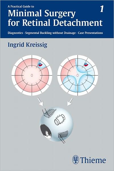 A Practical Guide to Minimal Surgery for Retinal Detachment, Vol. 1: Diagnostics, Segmental Buckling without Drainage, Case Presentations