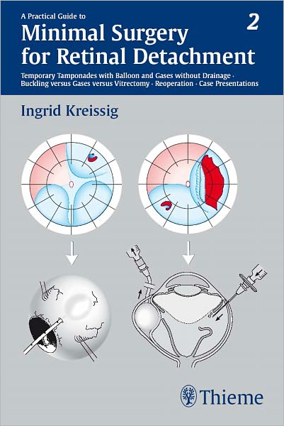 Practical Guide to Minimal Surgery for Retinal Detachment, Volume II