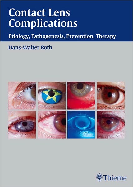 Contact Lens Complications: Etiology, Pathogenesis, Prevention, Therapy