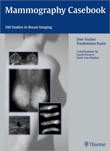 Mammography Casebook: 100 Studies in Breast Imaging