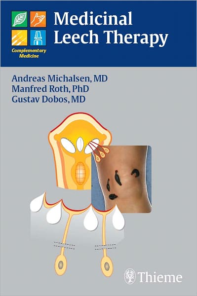 Medicinal Leech Therapy