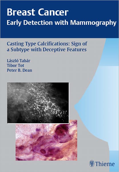 Casting Type Calcifications: Sign of a Subtype with Deceptive Features: Sign of a Subtype with Deceptive Features