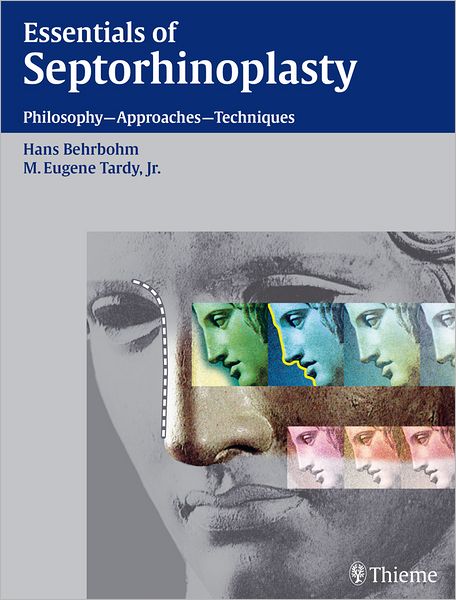 Essentials of Septorhinoplasty