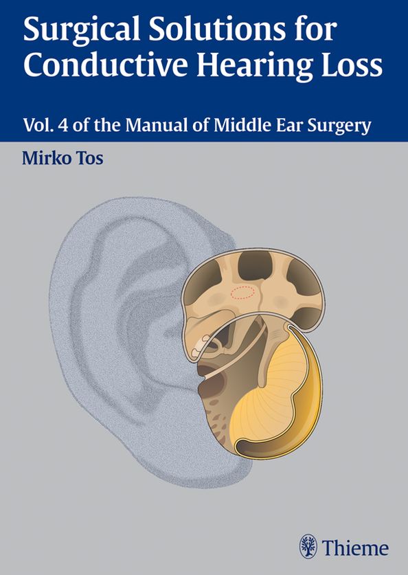 Surgical Solutions for Conductive Hearing Loss