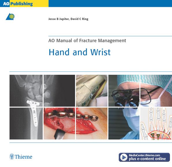 AO Manual of Fracture Management: Hand & Wrist