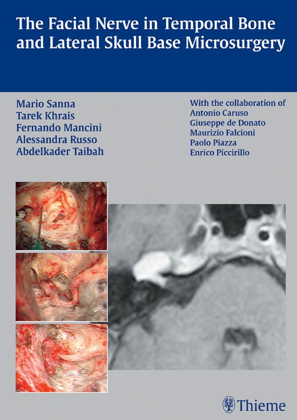 Facial Nerve in Temporal Bone and Lateral Skull Base Microsurgery