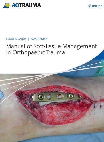 Manual of Soft-tissue Management in Orthopaedic Trauma