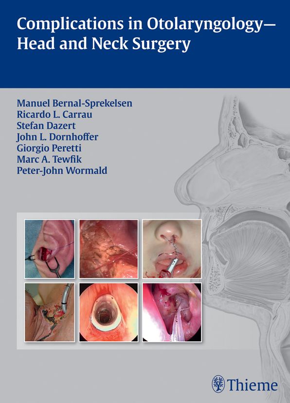 Complications in Otolaryngology - Head and Neck Surgery
