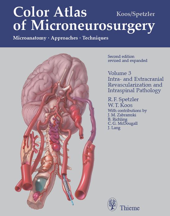 Color Atlas of Microneurosurgery, Volume 3: Intra- und Extracranial Revascularization and Intraspinal Pathology: Microanatomy, Approaches and Techniques