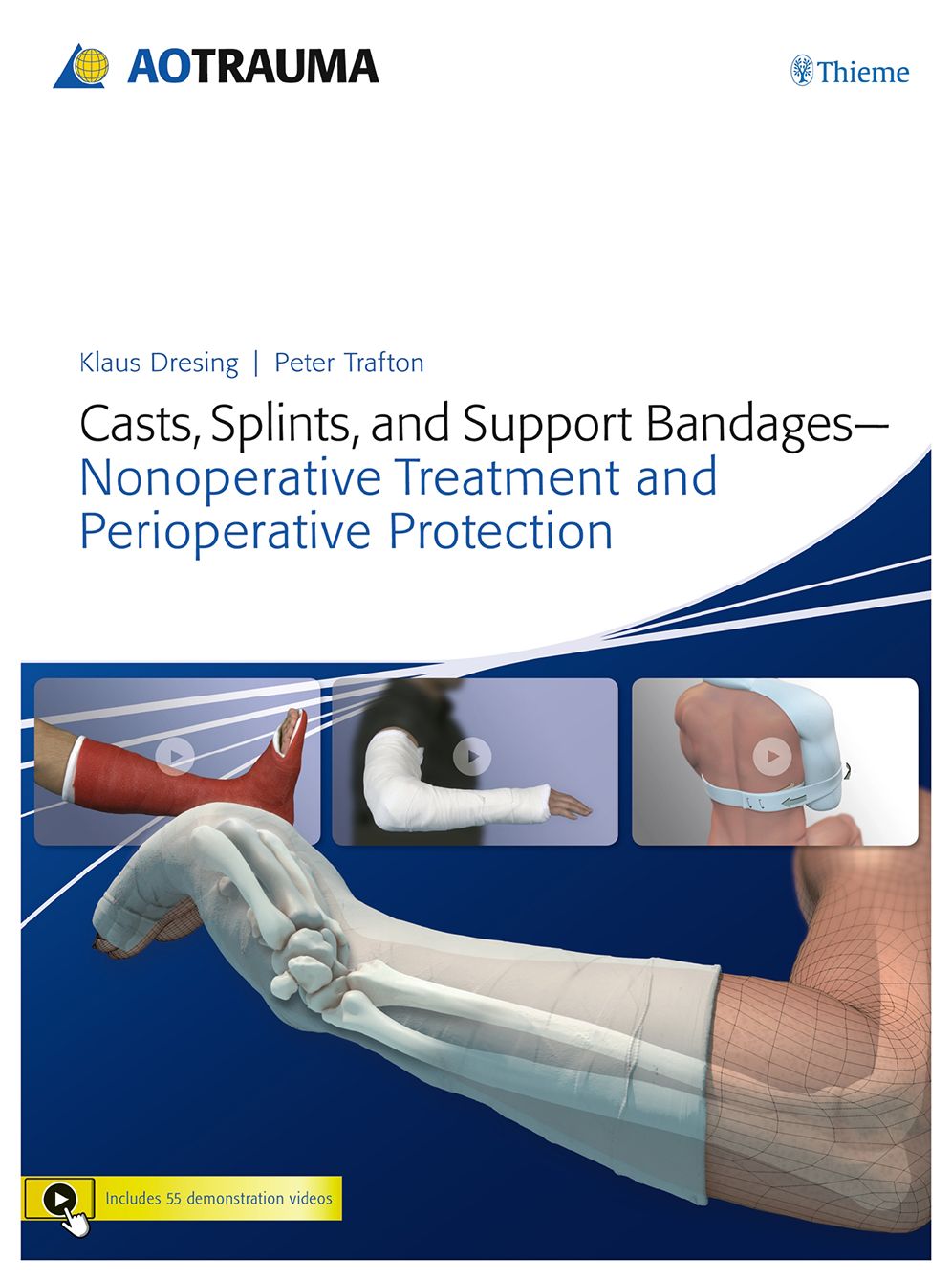 Casts, Splints, and Support Bandages: Nonoperative Treatment and Perioperative Protection