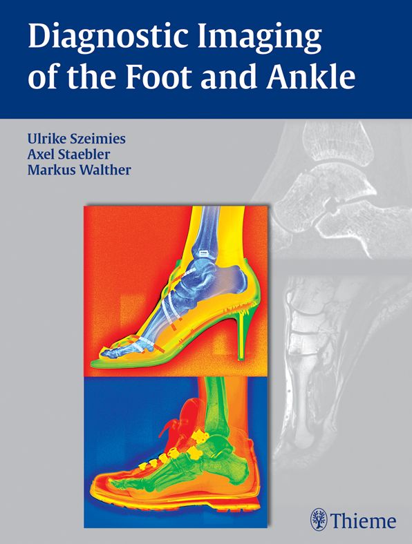 Diagnostic Imaging of the Foot and Ankle