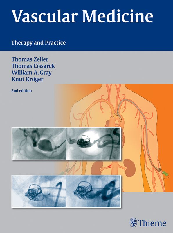 Vascular Medicine: Therapy and Practice