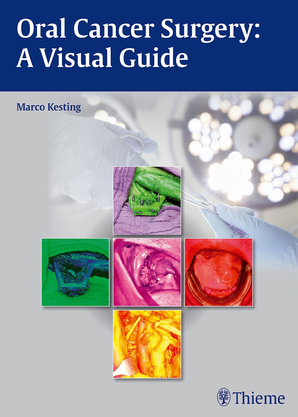 Oral Cancer Surgery: A Visual Guide: A Visual Guide