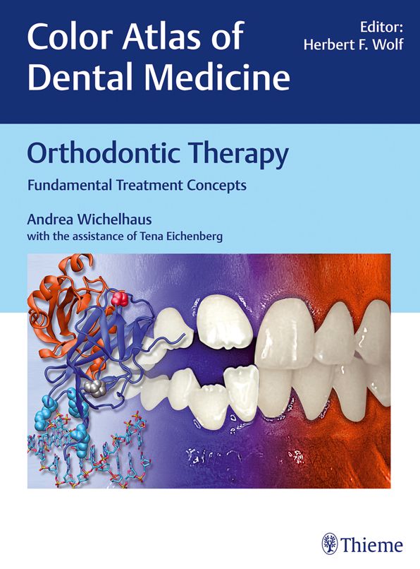 Orthodontic Therapy: Fundamental Treatment Concepts