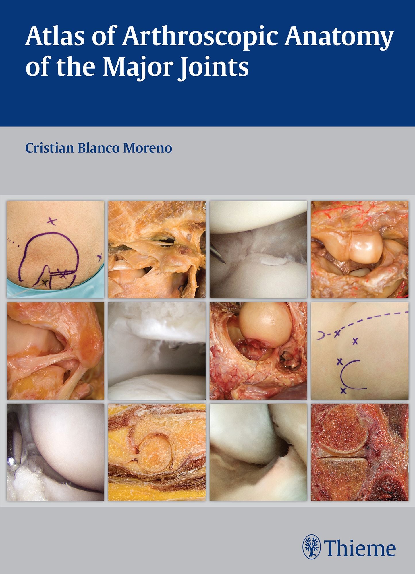 Atlas of Arthroscopic Anatomy of Major Joints