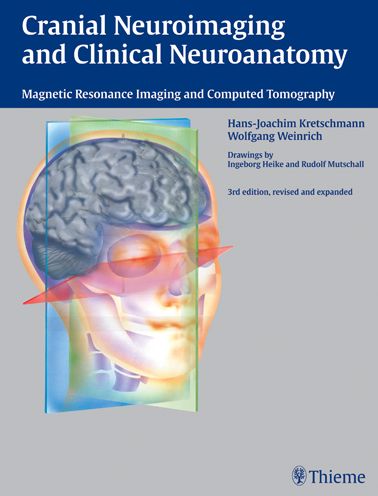 Cranial Neuroimaging and Clinical Neuroanatomy: Magnetic Resonance Imaging and Computed Tomography