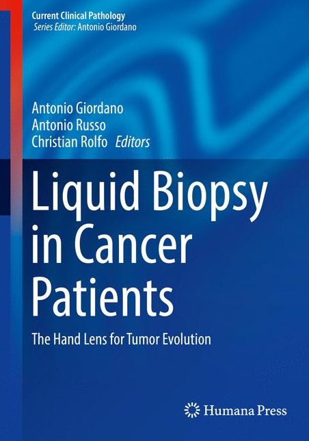 Liquid Biopsy in Cancer Patients: The Hand Lens for Tumor Evolution