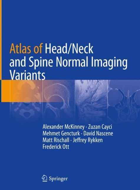 Atlas of Head/Neck and Spine Normal Imaging Variants